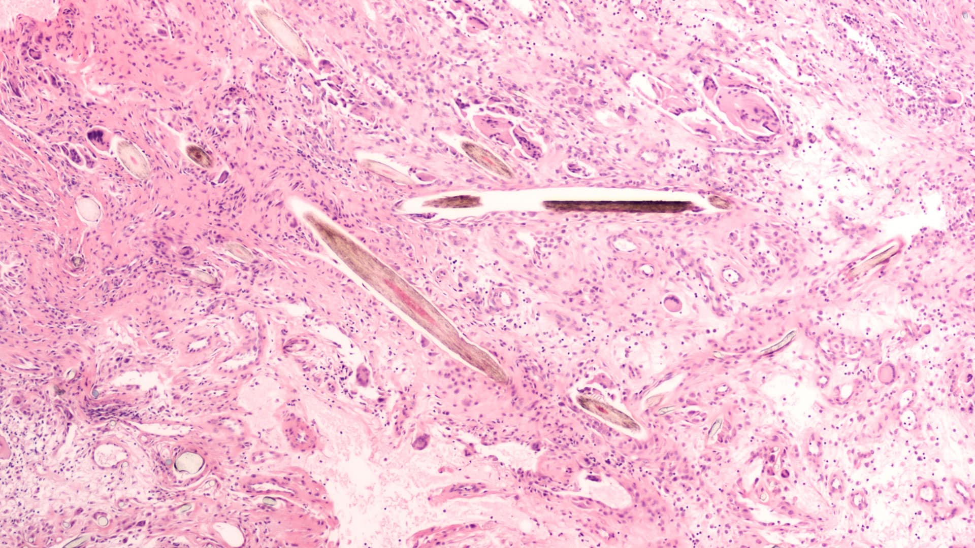 AdobeStock 287457739